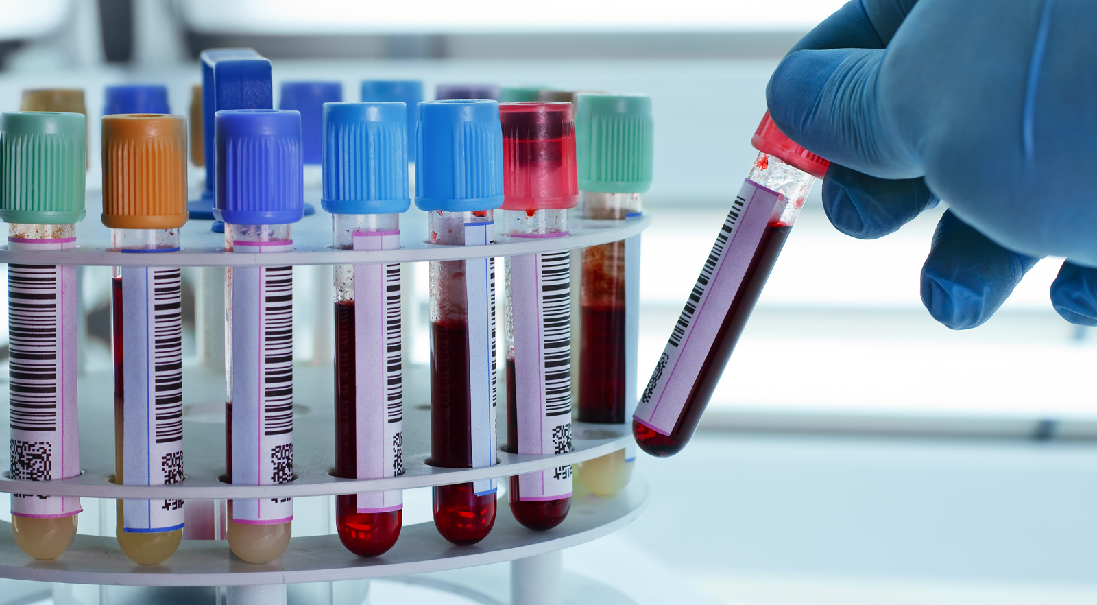 Pathology Lab Services in Bhosari